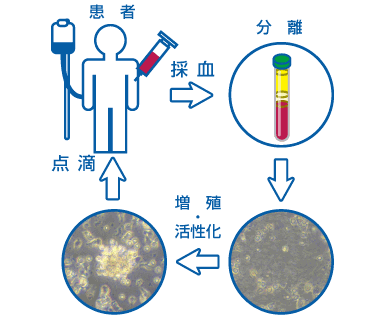 NK細胞の培養工程図